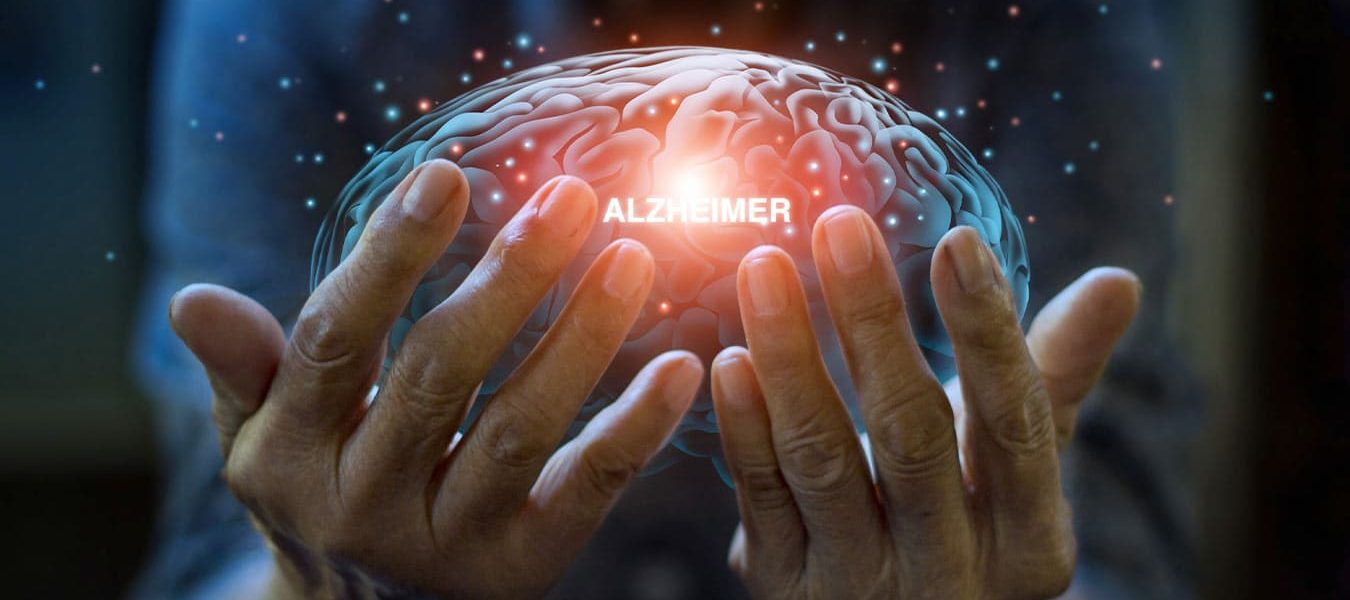 Una mirada diferente a pacientes con Alzheimer
