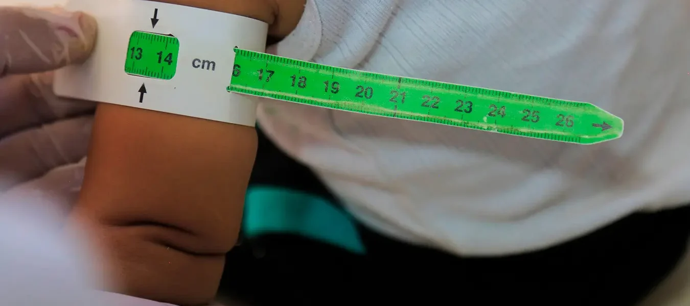 Lo que debes saber sobre la desnutrición en Ecuador