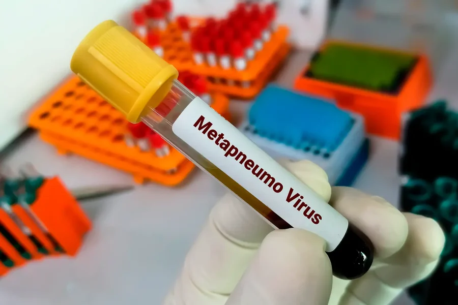 El Metapneumovirus humano: un invitado inesperado en nuestra realidad