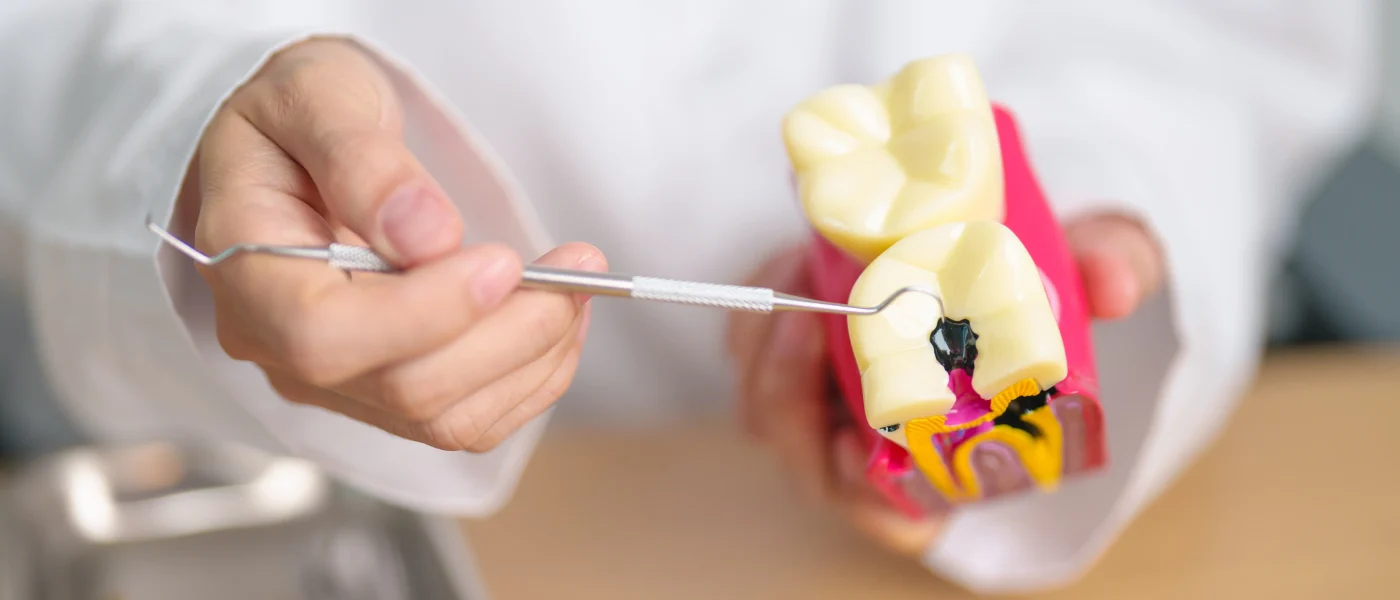 Efecto del pH salival en la formación y progresión de caries dentales