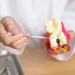 Efecto del pH salival en la formación y progresión de caries dentales